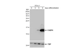 Anti-FABP4 antibody [HL1521] used in Western Blot (WB). GTX636995