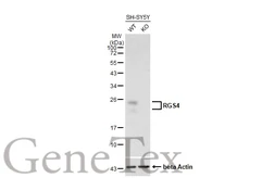 Anti-RGS4 antibody [HL1522] used in Western Blot (WB). GTX636996