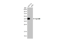 Anti-EpCAM antibody [HL1524] used in Western Blot (WB). GTX636998