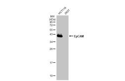 Anti-EpCAM antibody [HL1524] used in Western Blot (WB). GTX636998