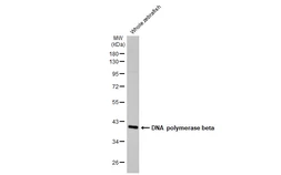 Anti-DNA polymerase beta antibody [HL1525] used in Western Blot (WB). GTX636999