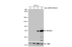 Anti-ACSL1 antibody [HL1530] used in Western Blot (WB). GTX637003