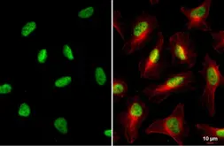 Anti-KAP1 antibody [HL1536] used in Immunocytochemistry/ Immunofluorescence (ICC/IF). GTX637010