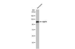 Anti-KAP1 antibody [HL1539] used in Western Blot (WB). GTX637013
