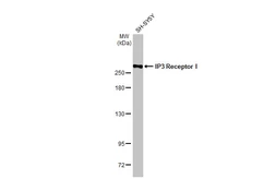 Anti-IP3 Receptor I antibody [HL1541] used in Western Blot (WB). GTX637015
