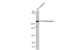 Anti-IP3 Receptor I antibody [HL1541] used in Western Blot (WB). GTX637015