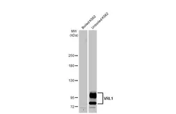 Anti-VRL1 antibody [HL1542] used in Western Blot (WB). GTX637017