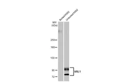 Anti-VRL1 antibody [HL1543] used in Western Blot (WB). GTX637018