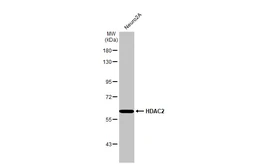 Anti-HDAC2 antibody [HL1545] used in Western Blot (WB). GTX637020