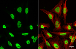 Anti-HDAC2 antibody [HL1545] used in Immunocytochemistry/ Immunofluorescence (ICC/IF). GTX637020