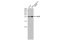 Anti-eIF4E antibody [HL1553] used in Western Blot (WB). GTX637028