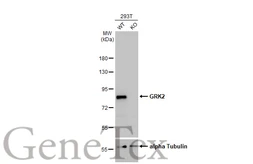Anti-GRK2 antibody [HL1562] used in Western Blot (WB). GTX637038