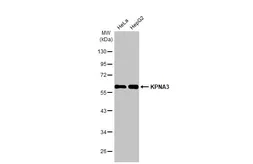 Anti-KPNA3 antibody [HL1573] used in Western Blot (WB). GTX637048