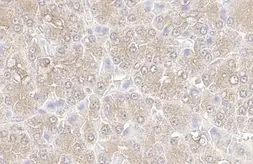 Anti-KPNA3 antibody [HL1573] used in IHC (Paraffin sections) (IHC-P). GTX637048