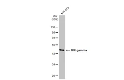 Anti-IKK gamma antibody [HL1577] used in Western Blot (WB). GTX637052