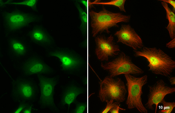 Anti-IKK gamma antibody [HL1577] used in Immunocytochemistry/ Immunofluorescence (ICC/IF). GTX637052