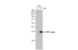 Anti-TNF alpha antibody [HL1579] used in Western Blot (WB). GTX637058