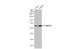 Anti-U2AF65 antibody [HL1583] used in Western Blot (WB). GTX637062