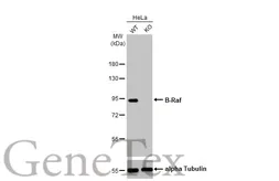 Anti-B-Raf antibody [HL1606] used in Western Blot (WB). GTX637085