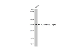 Anti-PI3 kinase C2 alpha antibody [HL1612] used in Western Blot (WB). GTX637103
