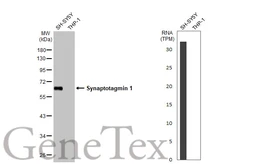 Anti-Synaptotagmin 1 antibody [HL1626] used in Western Blot (WB). GTX637119