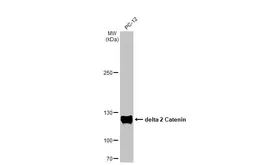 Anti-delta 2 Catenin antibody  [HL1629] used in Western Blot (WB). GTX637122