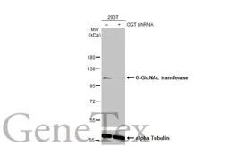 Anti-O-GlcNAc transferase antibody [HL1641] used in Western Blot (WB). GTX637222