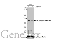Anti-O-GlcNAc transferase antibody [HL1642] used in Western Blot (WB). GTX637223