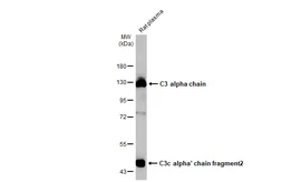 Anti-C3 antibody [HL1643] used in Western Blot (WB). GTX637224