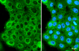 Anti-Human Papillomavirus type 16 E7 antibody [HL1647] used in Immunocytochemistry/ Immunofluorescence (ICC/IF). GTX637228
