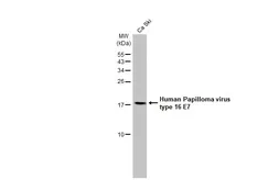 Anti-Human Papillomavirus type 16 E7 antibody [HL1647] used in Western Blot (WB). GTX637228