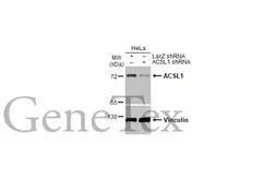 Anti-ACSL1 antibody [HL1651] used in Western Blot (WB). GTX637232