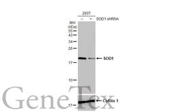 Anti-SOD1 antibody [HL1652] used in Western Blot (WB). GTX637250