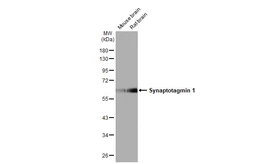 Anti-Synaptotagmin 1 antibody [HL1654] used in Western Blot (WB). GTX637252