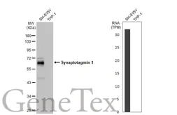 Anti-Synaptotagmin 1 antibody [HL1654] used in Western Blot (WB). GTX637252