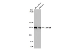 Anti-SNAP91 antibody [HL1657] used in Western Blot (WB). GTX637255