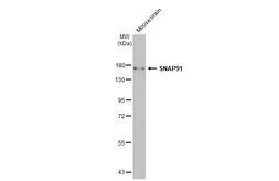 Anti-SNAP91 antibody [HL1657] used in Western Blot (WB). GTX637255