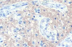 Anti-SNAP91 antibody [HL1657] used in IHC (Paraffin sections) (IHC-P). GTX637255
