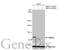 Anti-UBE3A antibody [HL1660] used in Western Blot (WB). GTX637258