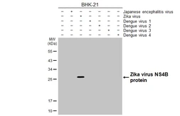 Anti-Zika virus NS4B protein antibody [HL1664] used in Western Blot (WB). GTX637262