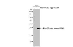 Anti-CD81 antibody [HL1666] used in Western Blot (WB). GTX637264
