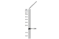 Anti-CD81 antibody [HL1666] used in Western Blot (WB). GTX637264