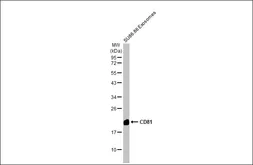 Anti-CD81 antibody [HL1667] used in Western Blot (WB). GTX637265