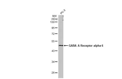 Anti-GABA A Receptor alpha 6 antibody [HL1669] used in Western Blot (WB). GTX637268