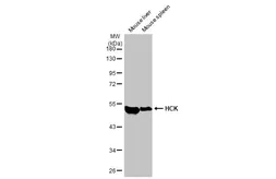 Anti-HCK antibody [HL1673] used in Western Blot (WB). GTX637272