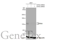 Anti-TFII-I antibody [HL1674] used in Western Blot (WB). GTX637273
