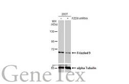 Anti-Frizzled 9 antibody [HL1675] used in Western Blot (WB). GTX637274