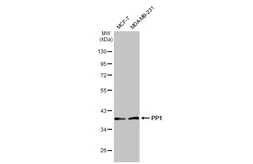 Anti-PP1 antibody [HL1677] used in Western Blot (WB). GTX637276