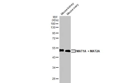 Anti-MAT1A + MAT2A antibody [HL1679] used in Western Blot (WB). GTX637278