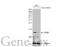 Anti-TCEB1 antibody [HL1683] used in Western Blot (WB). GTX637282